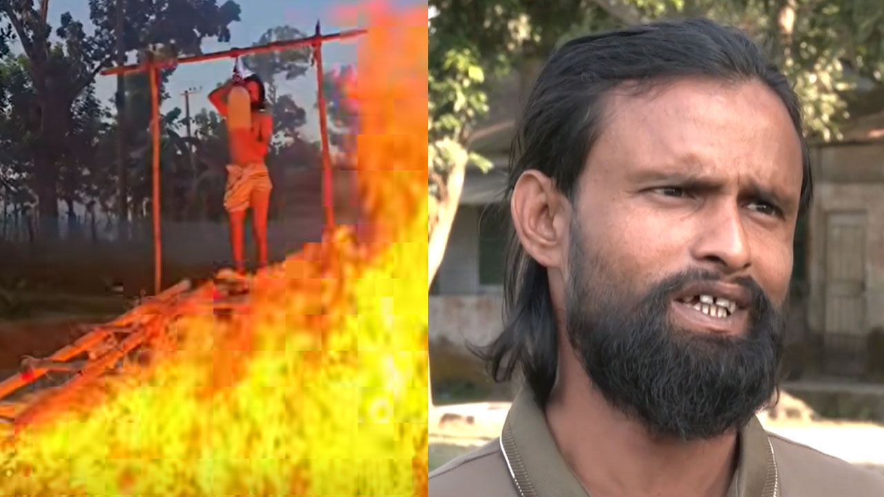 ভাইরাল হওয়ার নেশায় ভয়াবহ পরিণতি: আগুন নিয়ে ভিডিও বানাতে গিয়ে দগ্ধ আল-আমিন